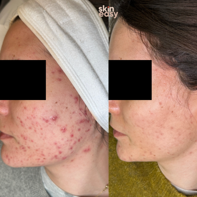 Rose de Mer® Peeling
